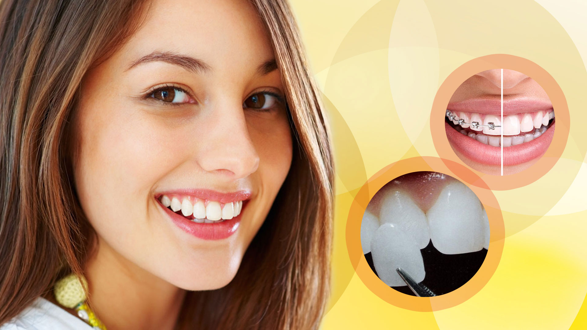 star smile makeover Shortcuts - The Easy Way